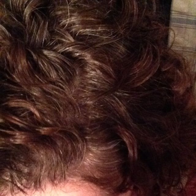 curls scalp